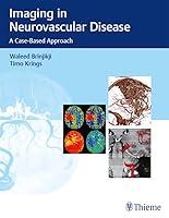 Algopix Similar Product 20 - Imaging in Neurovascular Disease A