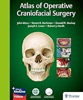 Algopix Similar Product 12 - Atlas of Operative Craniofacial Surgery