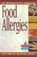 Algopix Similar Product 8 - Food Allergies: The Nutrition Now Series