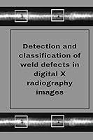 Algopix Similar Product 11 - Perception of weld defects in digital X