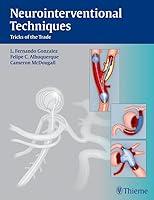 Algopix Similar Product 20 - Neurointerventional Techniques Tricks