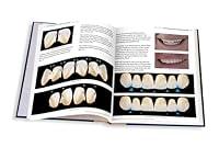 Algopix Similar Product 18 - Anterior Anatomy and the Science of a