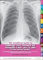 Algopix Similar Product 18 - Unofficial Guide to Radiology Chest