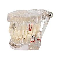 Algopix Similar Product 11 - Transparent Disease Teeth Model YOUYA