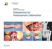 Algopix Similar Product 12 - Osteotomies for Posttraumatic