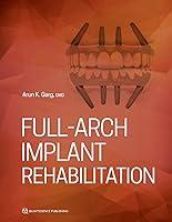 Algopix Similar Product 12 - Full-Arch Implant Rehabilitation