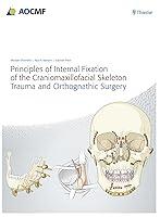 Algopix Similar Product 6 - Principles of Internal Fixation of the