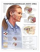 Algopix Similar Product 1 - Temporomandibular Joint TMJ