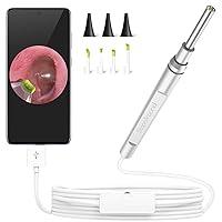 Algopix Similar Product 12 - ScopeAround Ear Wax Removal Endoscope