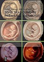 Algopix Similar Product 6 - 3D Ultrasound in Prenatal Diagnosis A