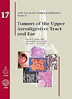 Algopix Similar Product 20 - Tumors of the Upper Aerodigestive Tract