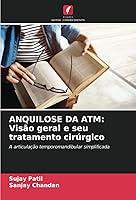 Algopix Similar Product 20 - ANQUILOSE DA ATM Viso geral e seu