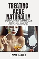 Algopix Similar Product 7 - TREATING ACNE NATURALLY Effective ways