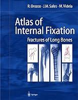 Algopix Similar Product 8 - Atlas of Internal Fixation Fractures