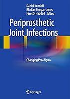 Algopix Similar Product 3 - Periprosthetic Joint Infections