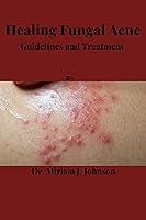 Algopix Similar Product 7 - Healing Fungal Acne Guidelines and