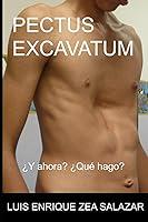 Algopix Similar Product 3 - PECTUS EXCAVATUM Y ahora Que hago