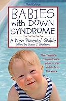 Algopix Similar Product 19 - Babies With Down Syndrome A New