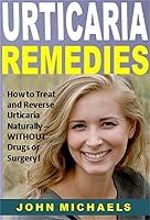 Algopix Similar Product 11 - Urticaria Remedies How to Treat and