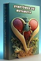 Algopix Similar Product 12 - Symptmes de Moyamoya Reconnatre les