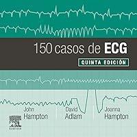 Algopix Similar Product 14 - 150 casos de ECG (Spanish Edition)