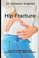 Algopix Similar Product 7 - Hip Fracture Pathophysiology