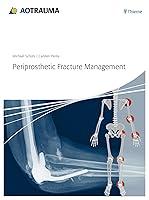 Algopix Similar Product 10 - Periprosthetic Fracture Management