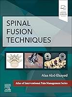 Algopix Similar Product 17 - Spinal Fusion Techniques - E-Book