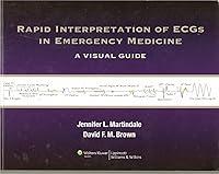 Algopix Similar Product 5 - Rapid Interpretation of ECGs in