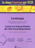 Algopix Similar Product 3 - CARDIOLOGIE LECTURE D ECG CAS CLINIQUES