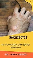 Algopix Similar Product 11 - BAKERS CYST ALL THE WHATS OF BAKERS