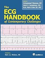 Algopix Similar Product 9 - ECG Handbook of Contemporary Challenges