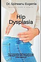 Algopix Similar Product 17 - Hip Dysplasia Pathophysiology