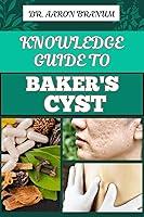 Algopix Similar Product 1 - KNOWLEDGE GUIDE TO BAKERS CYST 