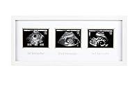 Algopix Similar Product 11 - Pearhead Sonogram Progression Frame 