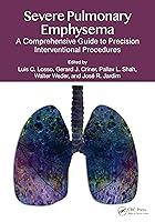 Algopix Similar Product 11 - Severe Pulmonary Emphysema A