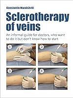 Algopix Similar Product 16 - Sclerotherapy of Veins  An informal