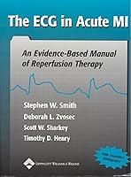 Algopix Similar Product 13 - The ECG in Acute MI An EvidenceBased