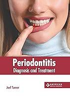 Algopix Similar Product 14 - Periodontitis: Diagnosis and Treatment