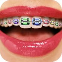 Algopix Similar Product 14 - Teeth Braces Booth - Funny Face Filters