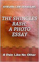 Algopix Similar Product 3 - The Shingles Rash A Photo Essay A