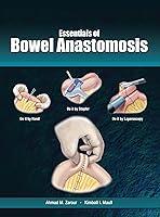 Algopix Similar Product 9 - Essentials of Bowel Anastomosis