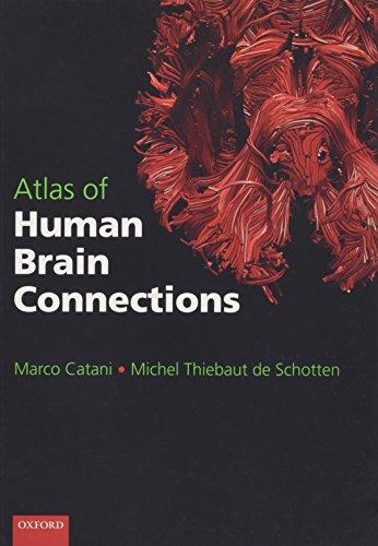 Algopix Similar Product 16 - Atlas of Human Brain Connections